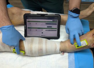 Aspen Medical and NIRSense support Ukrainian defence medics NIRSense limb perfusion assessment post surgery